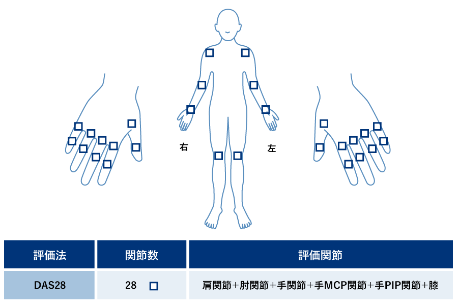 DAS28で評価される関節